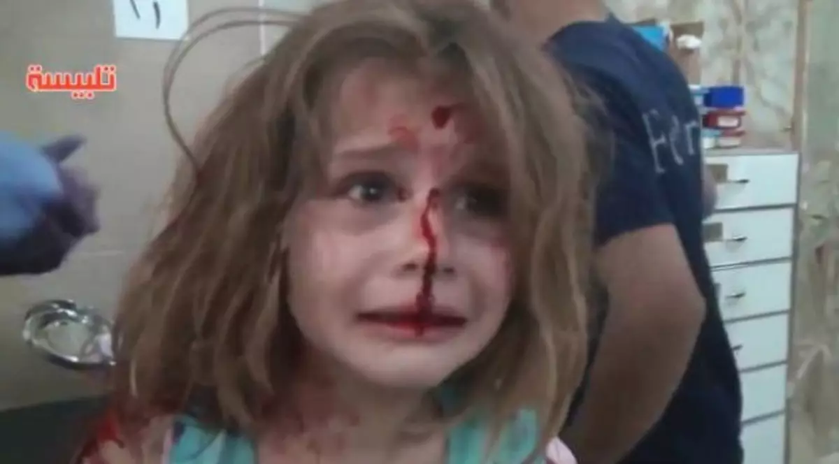Înregistrare dramatică | Momentul în care o fetiță din Siria, rănită în urma unui raid aerian, strigă după tatăl ei