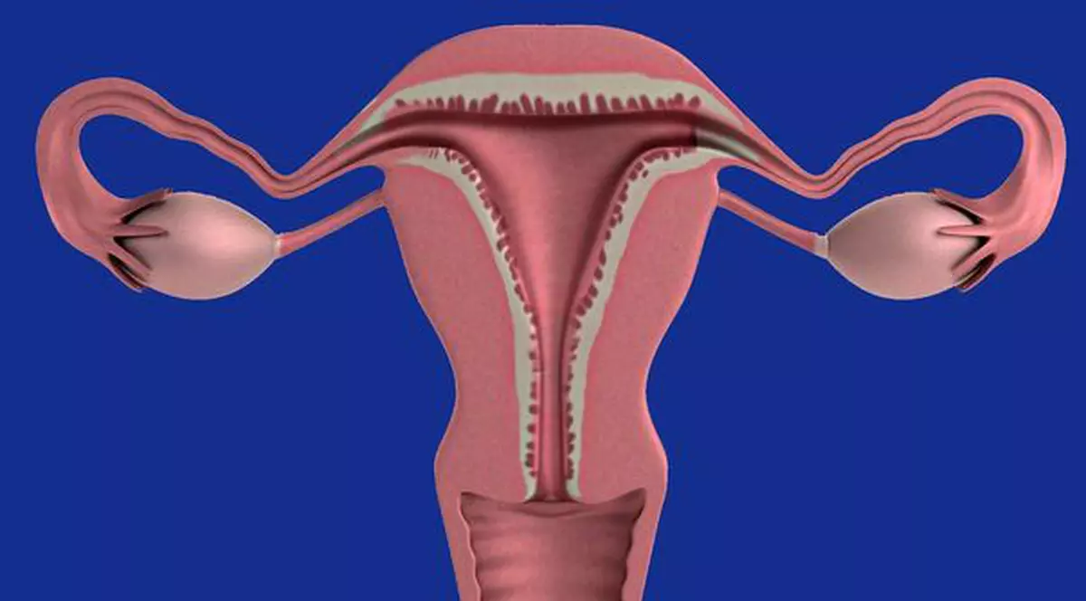 Cancerul de col uterin nu are simptome în primă fază
