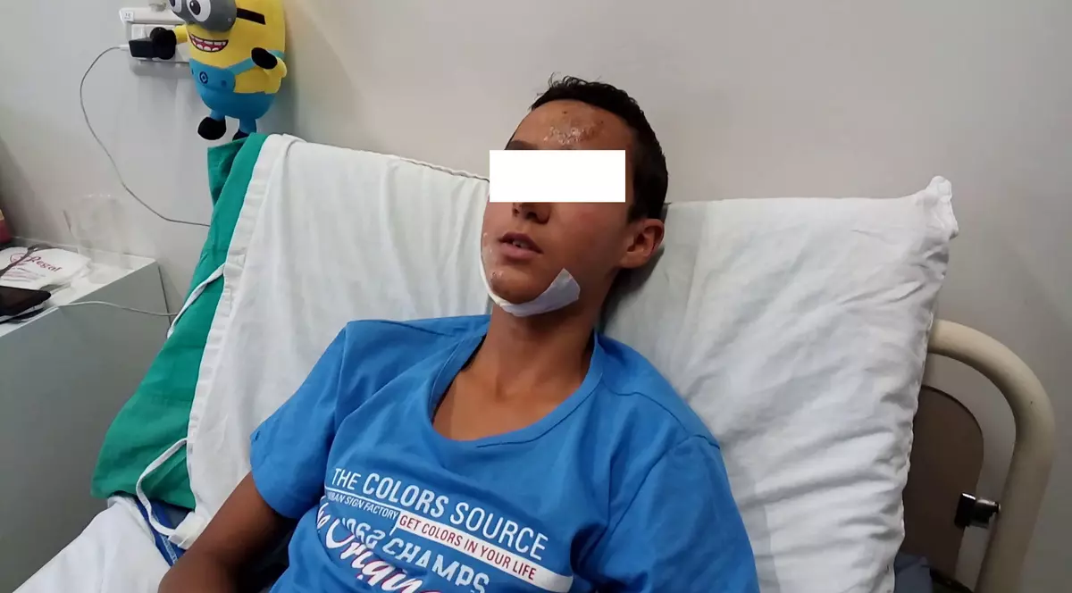 Un copil a ajuns la spital din cauza unui polițist beat
