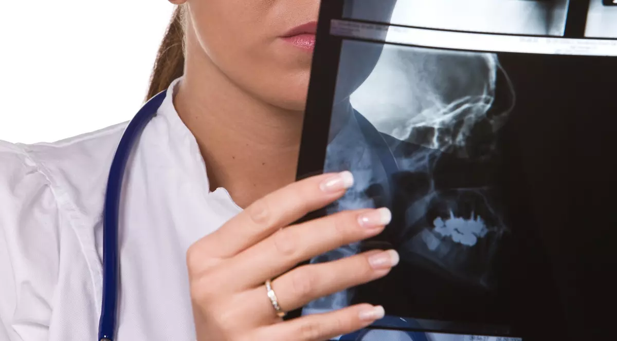 Un medic se uita la o radiografie