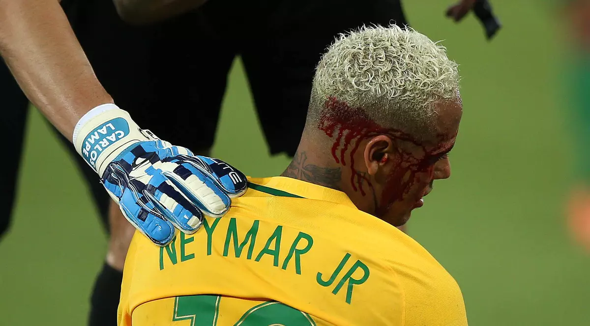 Brazilianul Neymar, cu fața plină de sânge, arată precum un luptător în cușcă