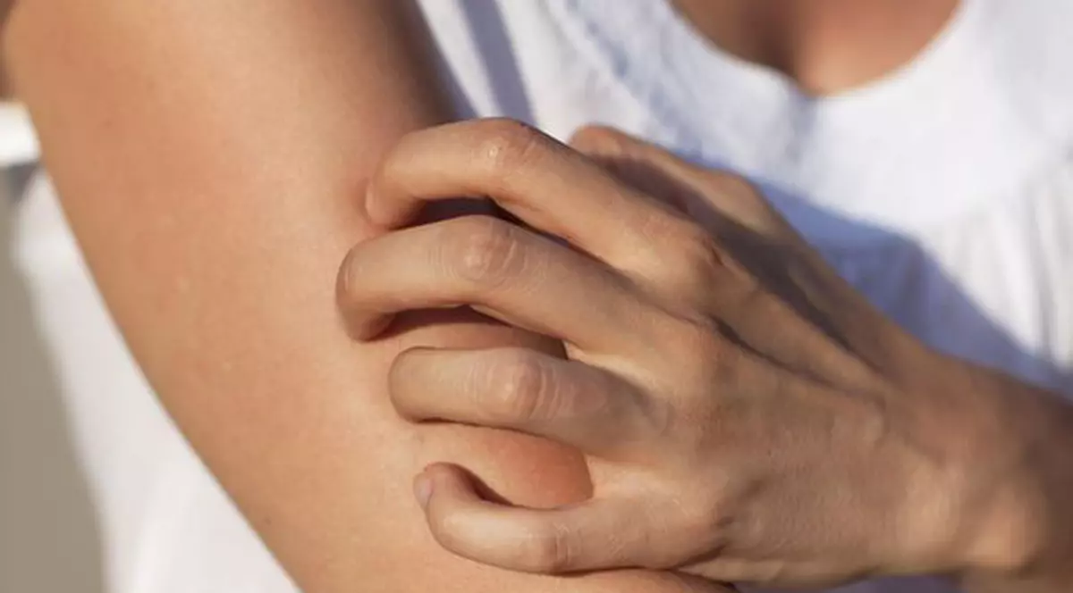 Neurodermatita îți poate afecta viața sexuală