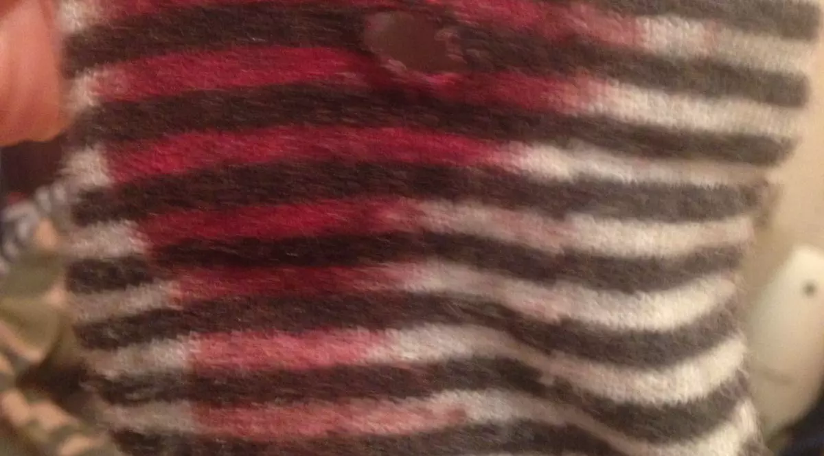 Copil plecat cu o gaură în talpă de la un loc de joacă din mall