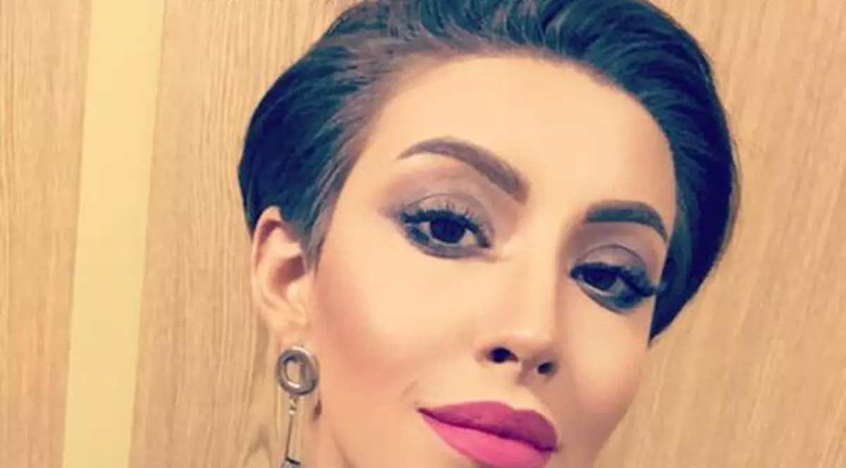 Nicoleta Nucă s-a operat la nas. Primele declarații după intervenția suferită