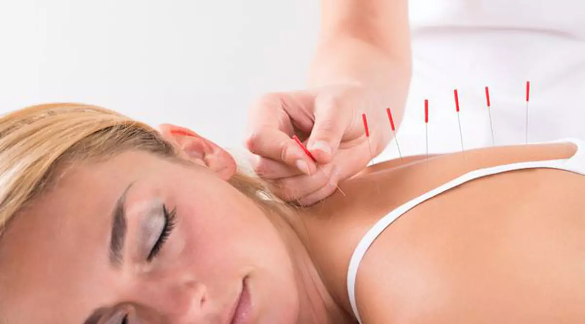 Ce afecțiuni tratează acupunctura