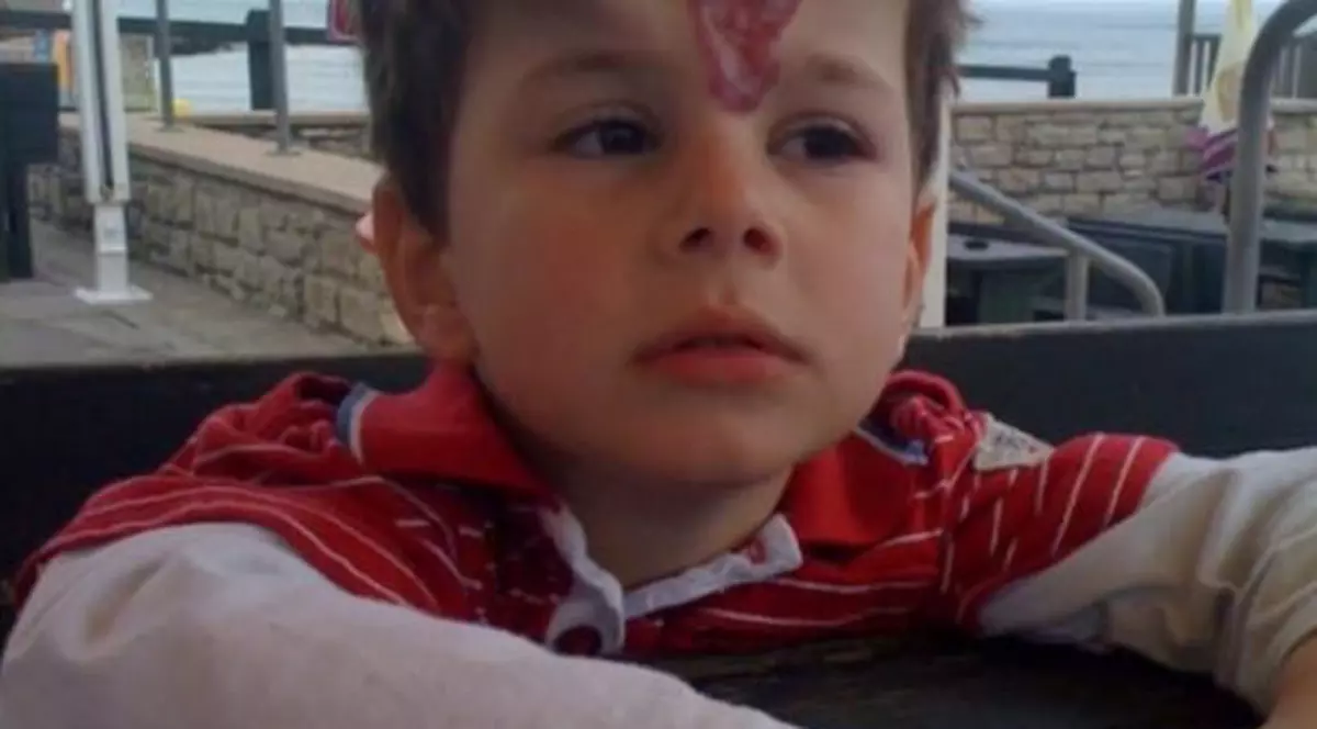 Cei care il vad pentru prima data spun ca e copilul diavolului! De ce are baiatul acesta doua coarne pe frunte