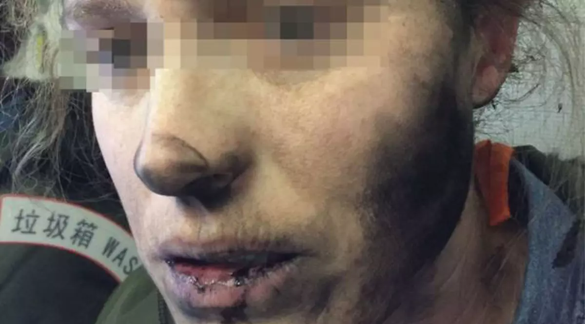 O femeie a fost rănită de căștile sale, care au explodat în timpul unui zbor