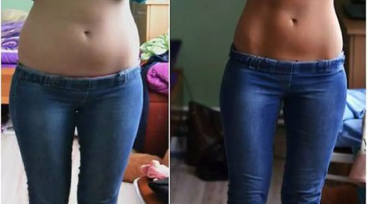 (P) Capsula de slabit naturala - Rezultatele depasesc asteptarile! Slabesti pana la 20 kg!