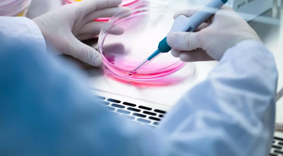 Screloza multiplă, tratată cu ajutorul celulelor stem