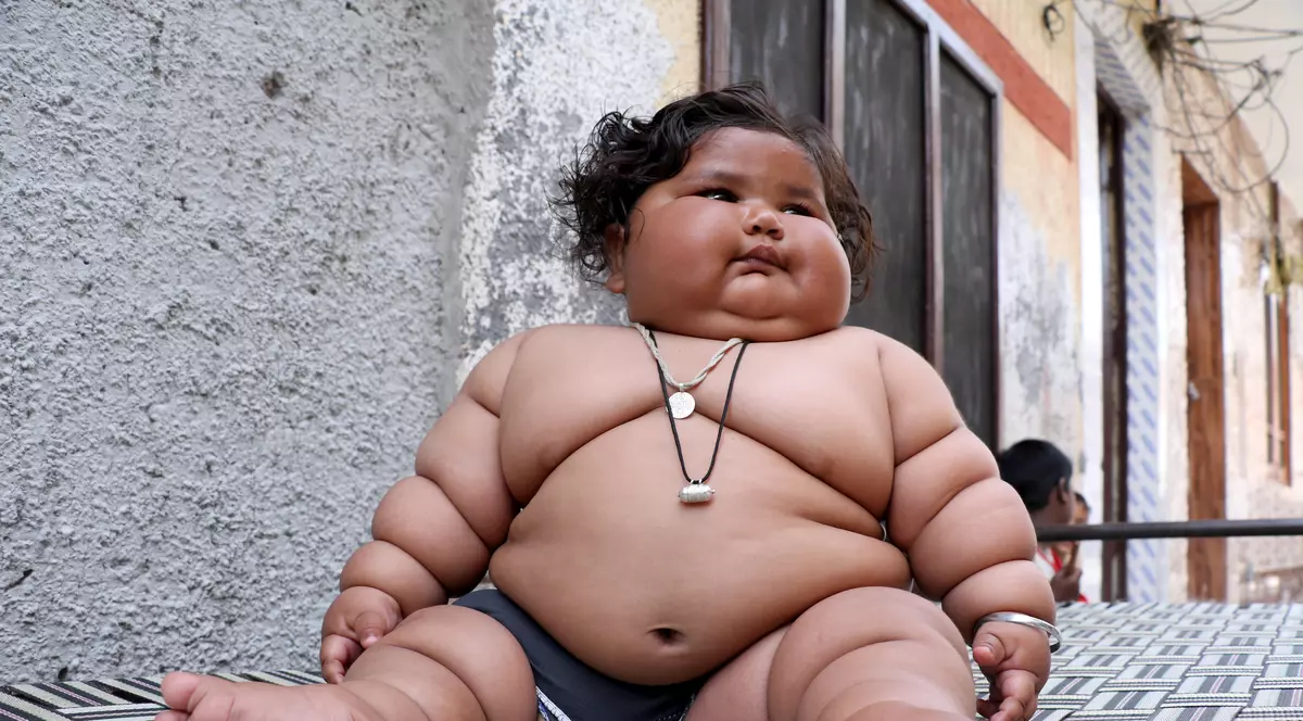 Bebeluș obez în India. La opt luni, o fetiță cântărește 17 kilograme