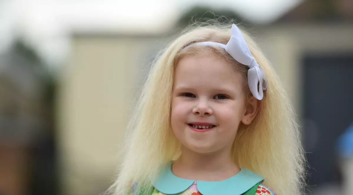 O fetiță de cinci ani nu poate să fie … pieptănată. Micuța suferă de sindromul părului de nepieptănat, la fel ca Albert Einstein