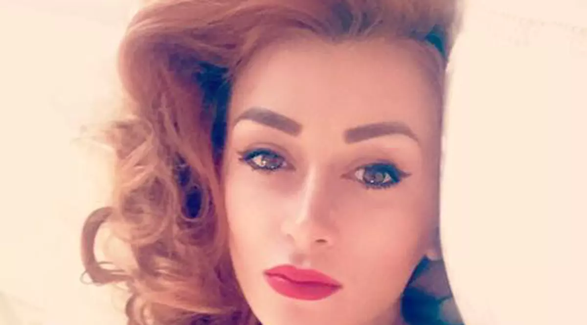 Denisa Tănase de la Bambi s-a botoxat. Cum arată la 3 zile după tratament