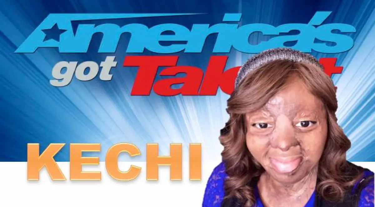 Kechi Okwuchi , Supraviețuitoarea unui accident aviatic a impresionat la America’s Got Talent -