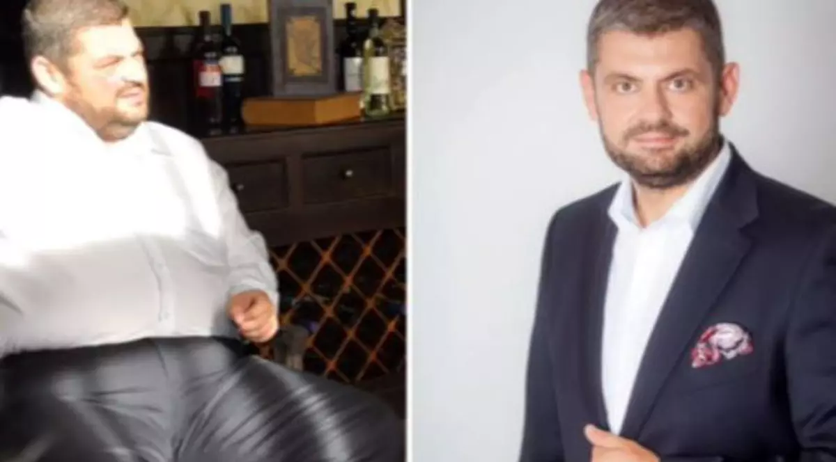 Doctorul Florin Bălănică a slăbit 100 de kilograme în 8 luni fără să facă sport