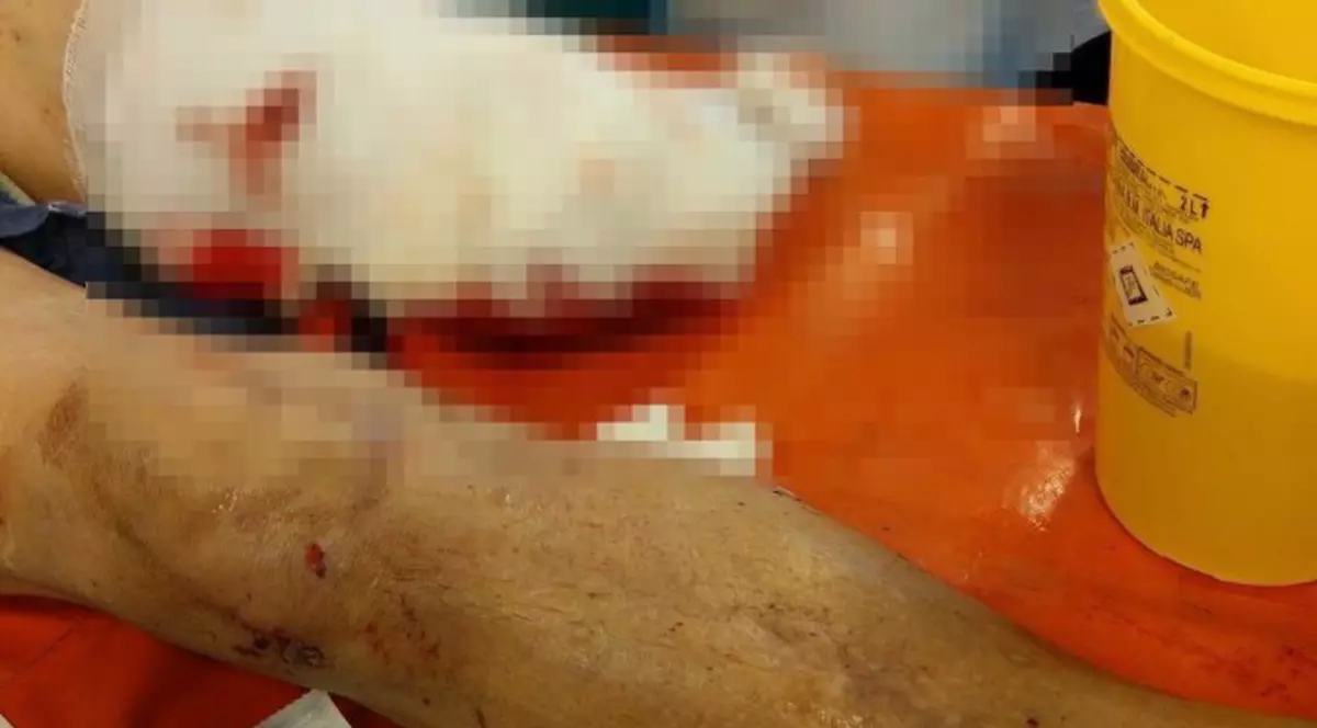 O femeie a fost lovită de tren în Babadag