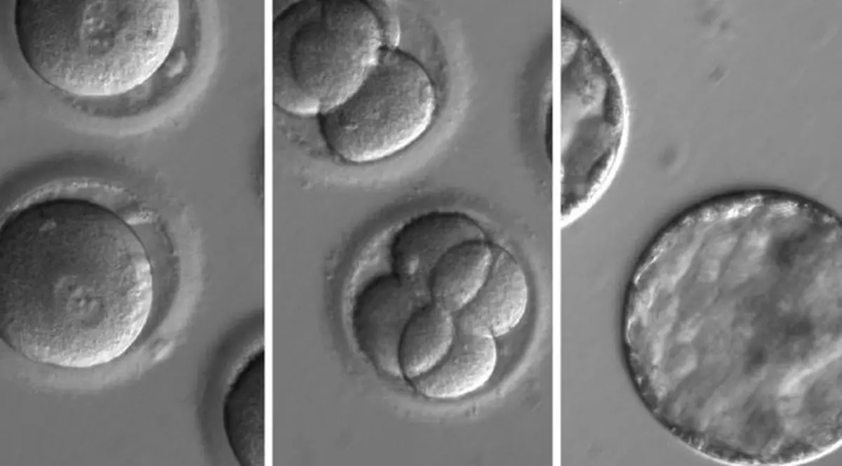 Premieră mondială! Oamenii de știință au reușit să corecteze gene defectuoase ale unor embrioni umani