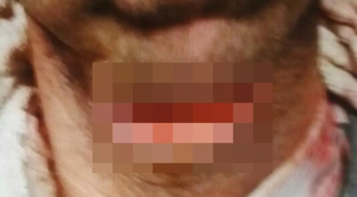 înjunghiat de propriul frate, în Vaslui