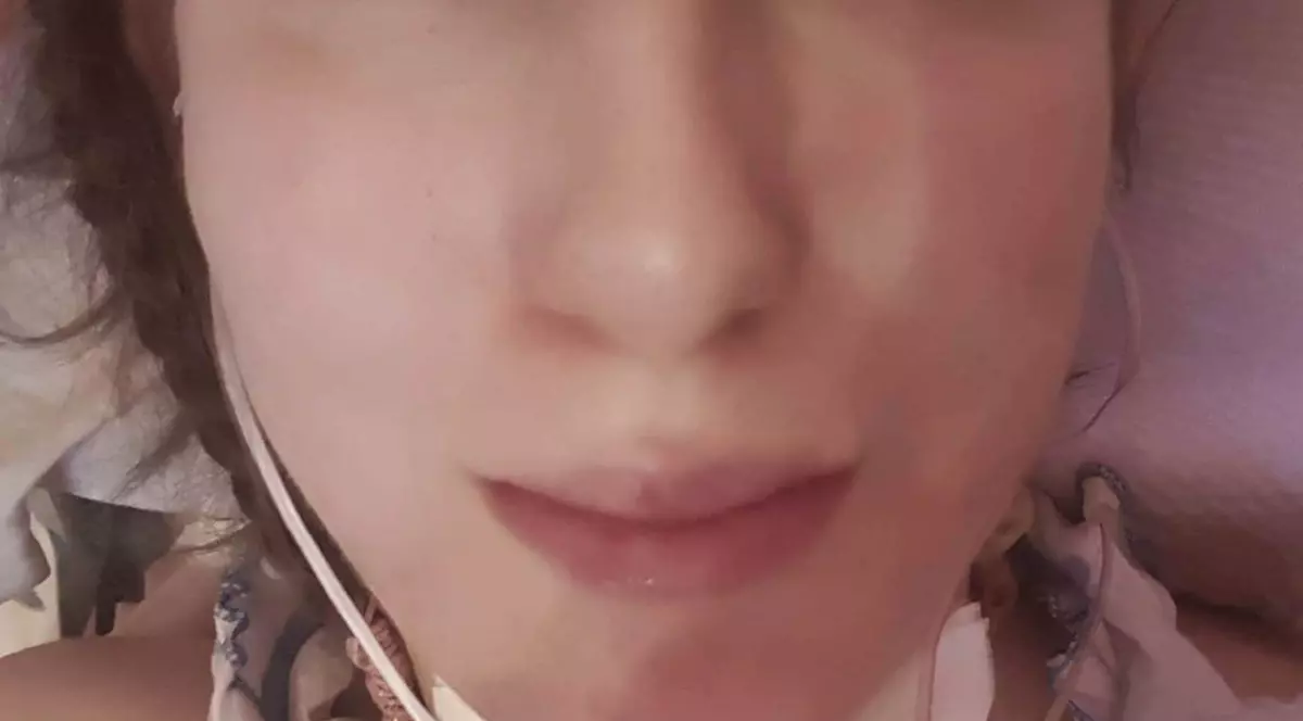 S-o ajutăm pe Oana în lupta grea pe care o duce din copilărie. Tânăra are nevoie urgent de un umidificator, fără de care s-ar putea sufoca în orice moment