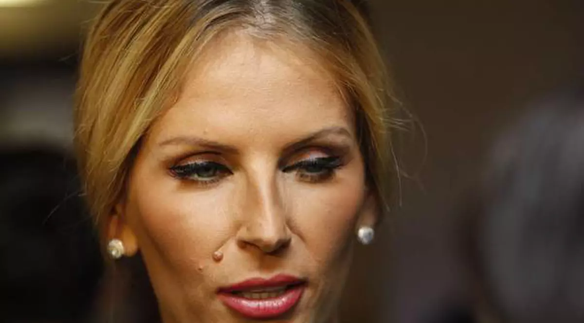 Andreea Bănică, accident pe scenă. Un dansator i-a rupt dinții | VIDEO