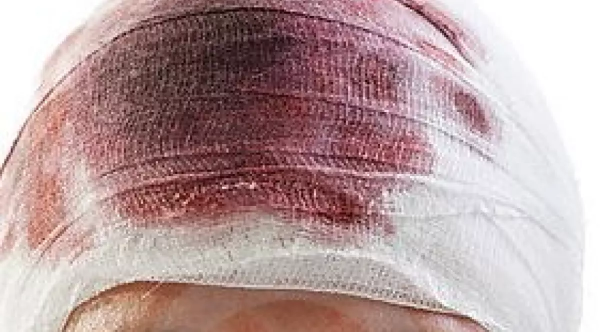 a ajuns la spital mort de beat acuzând că a fost lovit cu o sabie