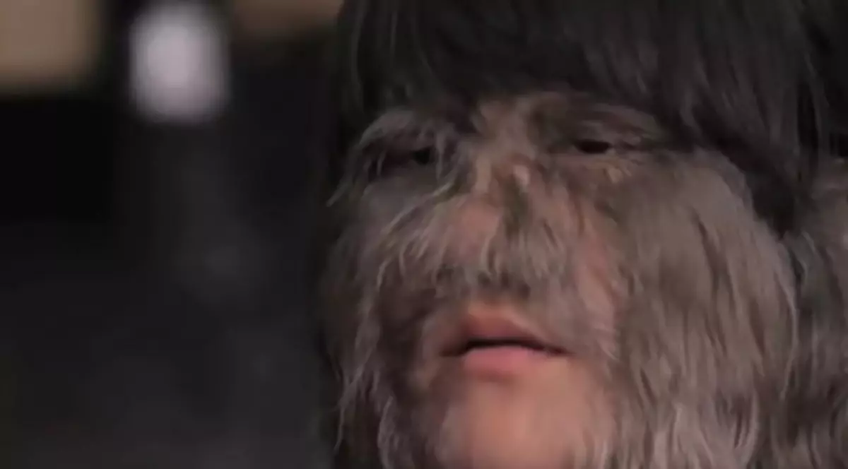 Cea mai păroasă fată din lume s-a măritat