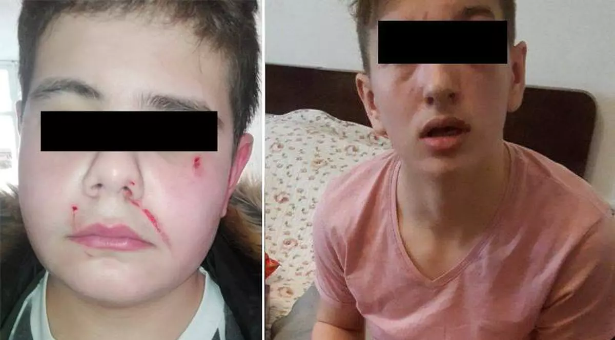 Psihologul Libertatea, despre elevii bătuți de părinții colegilor de școală: “E ca în lumea animală, unde puii sunt apărați cu prețul vieții”