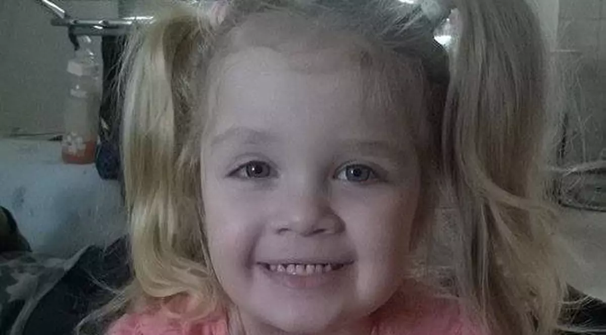 A cincea operație pentru Teodora. Fetița suferă de nev congenital gigant din prima zi de viață și a fost operată în America