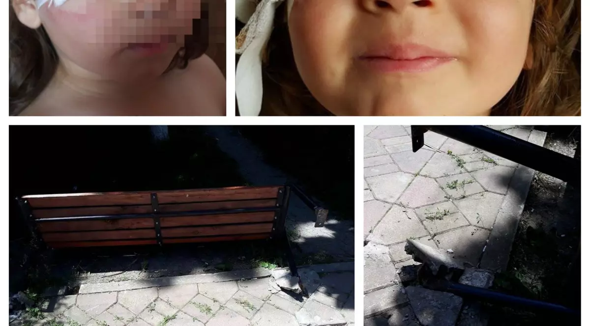Un copil a fost rănit într-un parc din Murfatlar. O bancă s-a prăbușit peste el