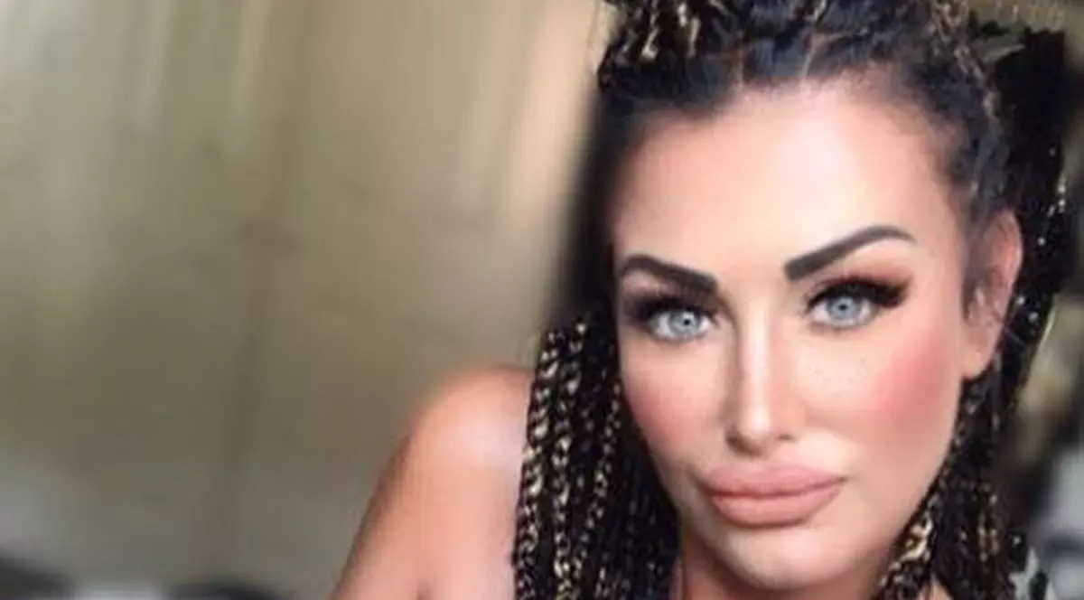 FOTO | O femeie care a cheltuit mii de euro pe operații estetice dă vina pe păpușile Barbie pentru adicția ei