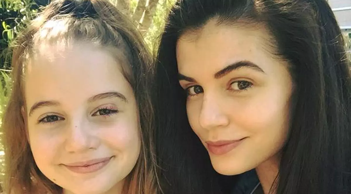 Ce este șalazionul, afecțiunea cu care a fost diagnosticată Irina Columbeanu