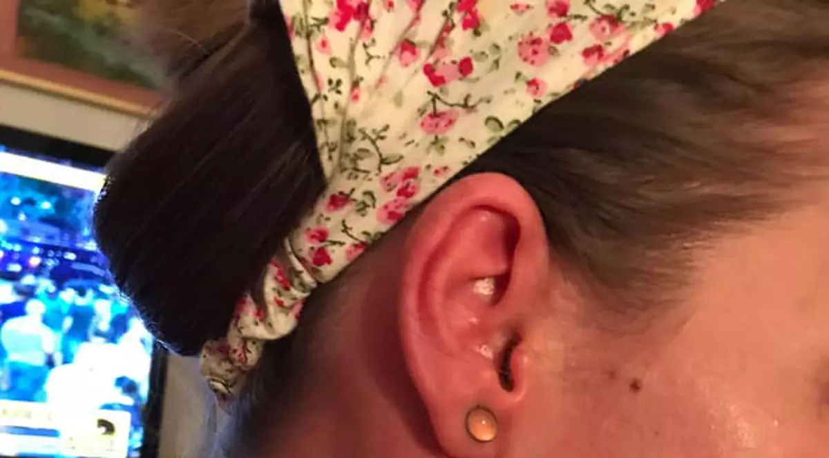 Jurnalista Nora Dincă este grav afectată de expunerea la gazele toxice. Cum arăta după protest