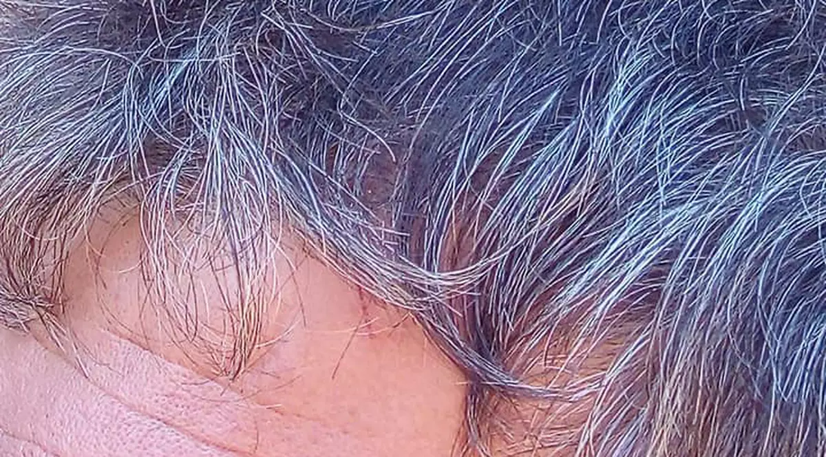 Primarul comunei Hârseni din Brașov ar fi bătut un localnic. Bărbatul a ajuns în stare gravă la spital