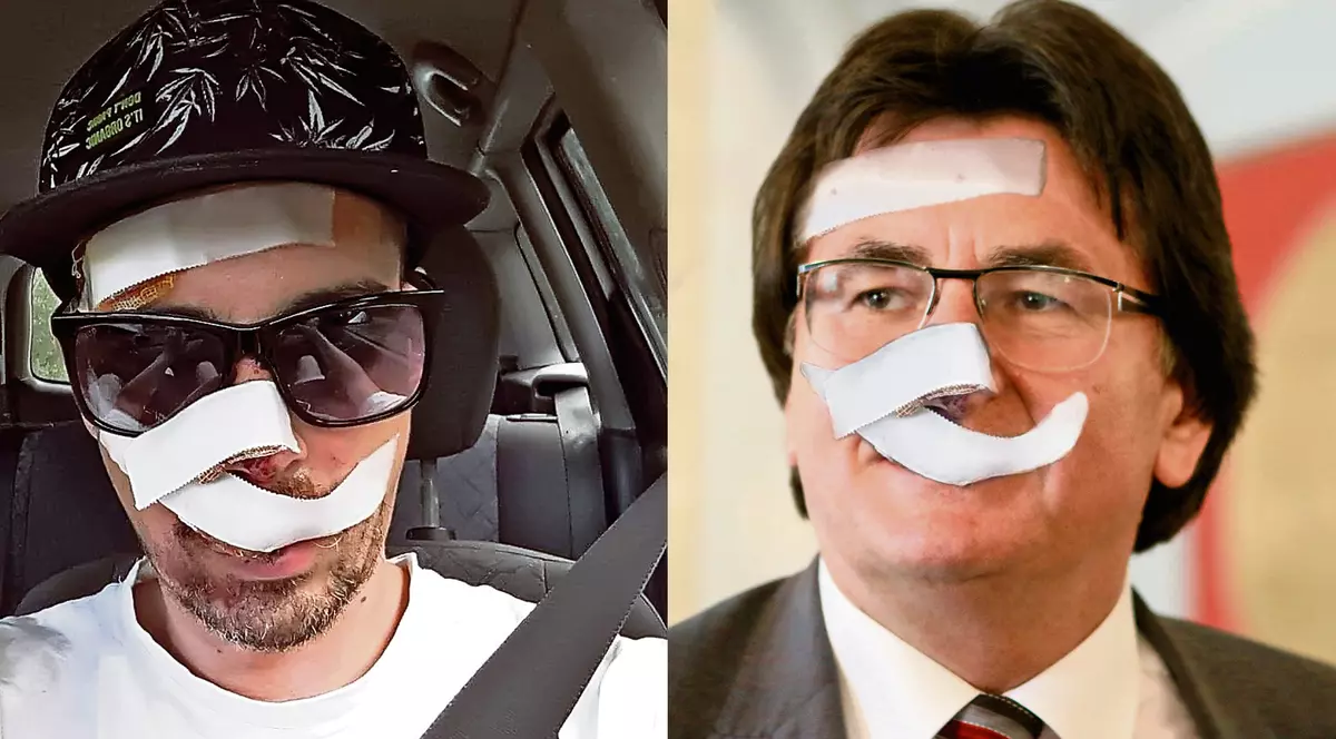 Domnule primar Robu, aveți grijă când mergeți cu bicicleta prin Timișoara! Puteți ajunge așa, ca tânărul care a căzut în groapa de pe trotuar