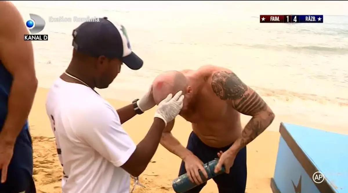 Războiniciul Doru s-a lovit la cap în timpul confruntării cu Faimosul Ferucio. Medicul a intervenit de urgență la Exatlon