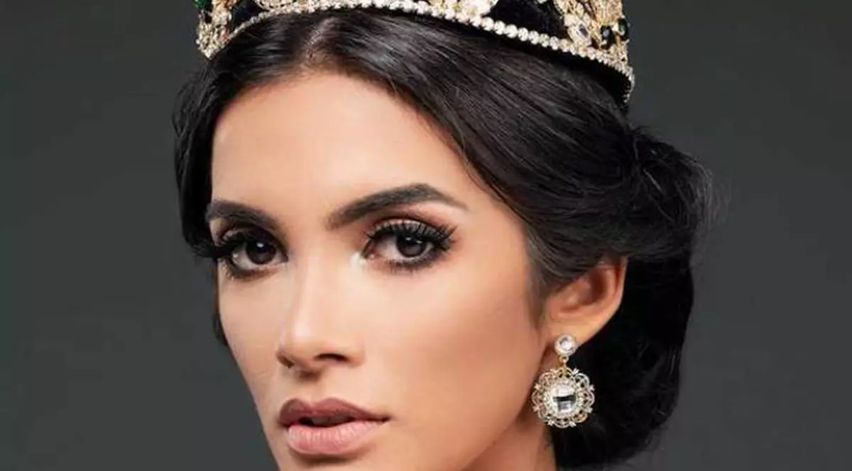 Miss Paraguay a leșinat pe scenă. S-a întâmplat în cel mai important moment din viața ei | FOTO