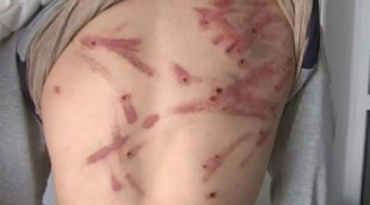 Un tată și-a snopit copiii în bătaie cu o sârmă: 