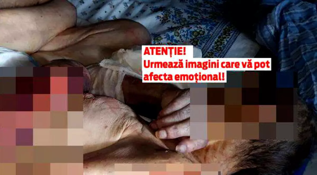 Rana din inima noastră. Bătrâna de 79 de ani pasată între familie și spital arată gradul de cinism la care au ajuns atât oamenii, cât și instituțiile