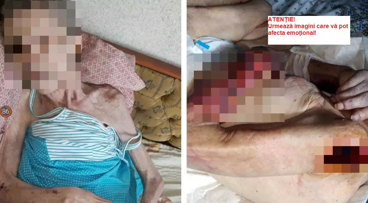 Fiul femeii externate cu 9 escare îi răspunde managerului Spitalului Pantelimon: "Iat-o pe mama înainte și după internare! Să ne spună cum e situația ameliorată"
