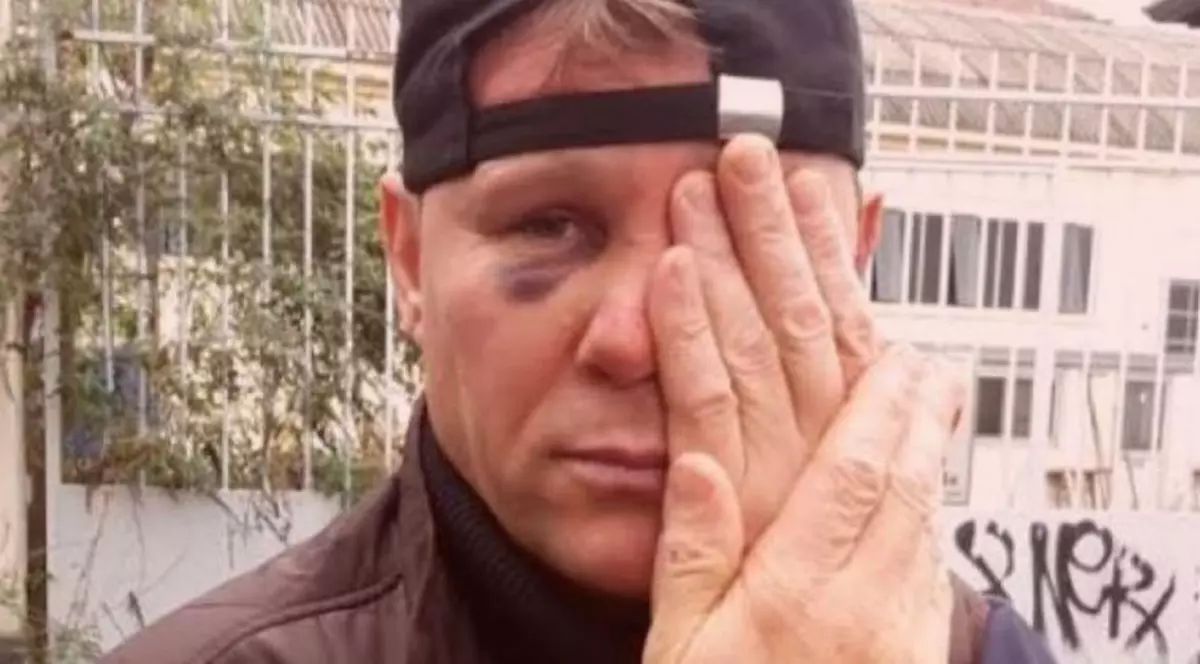 Un român a devenit erou la Milano după ce și-a riscat viața pentru a-și face datoria: "Mi-au dat cu ranga în față, mi-au înfipt o șurubelniță în spate!"