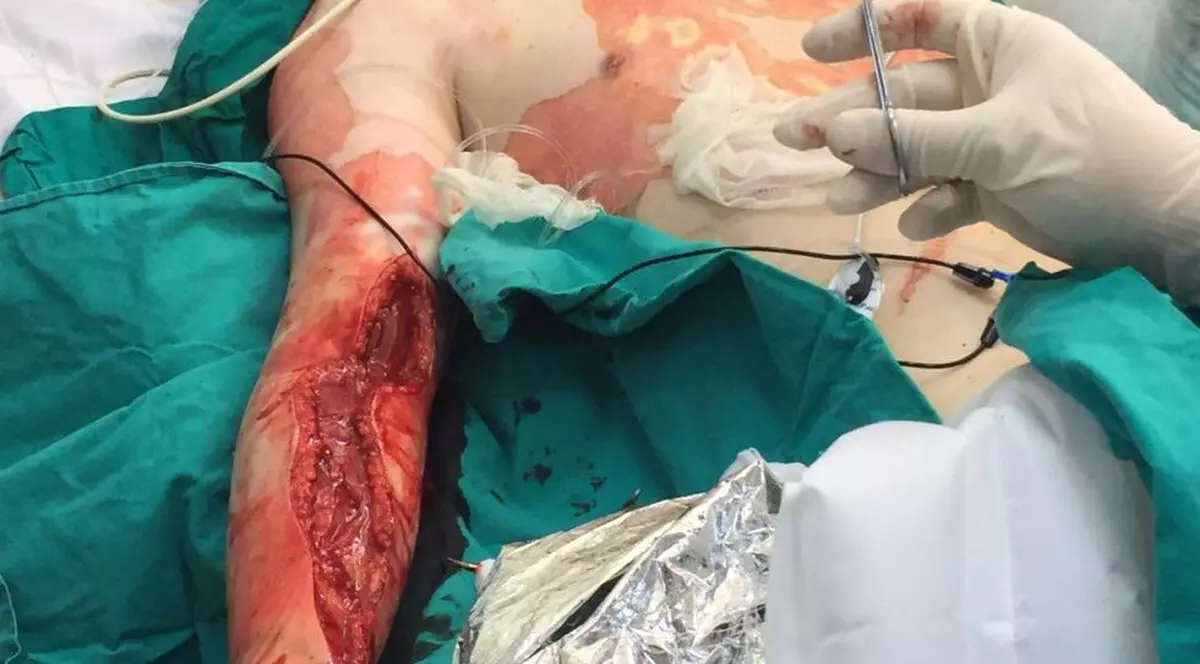 SECRETELE "COLECTIV" ÎN IMAGINI ȘI DOCUMENTE: Chirurgul Emanuel Albu a cerut, încă din prima zi, în foaia de observație, transferul rănitului Roberto Vlăduț! Vlăduț pleacă ultimul și moare!