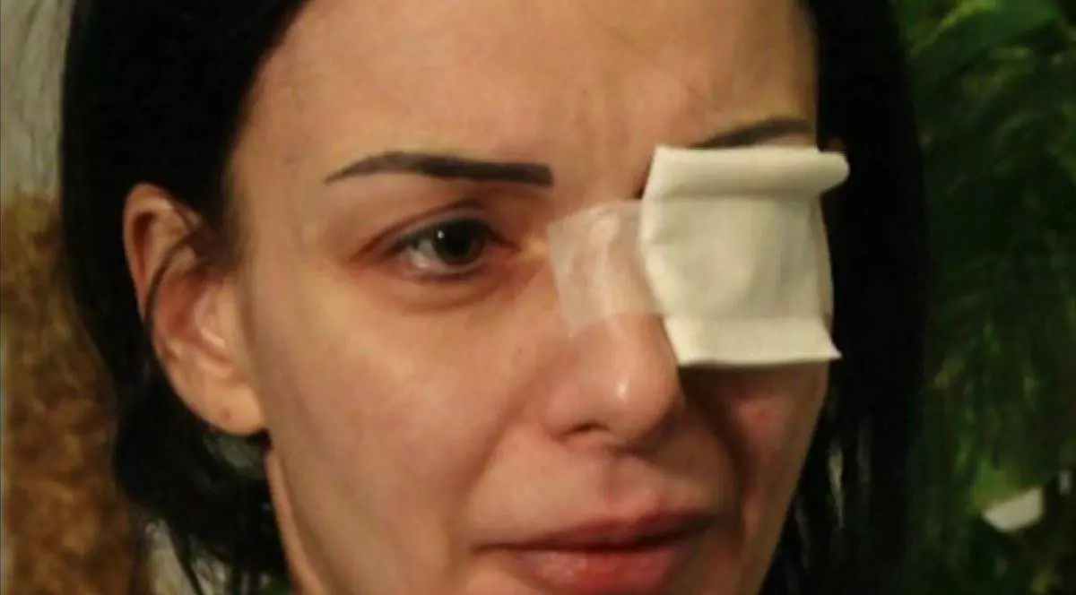 Mărturiile cutremurătoare, făcute de Alina, românca atacată cu acid în Italia