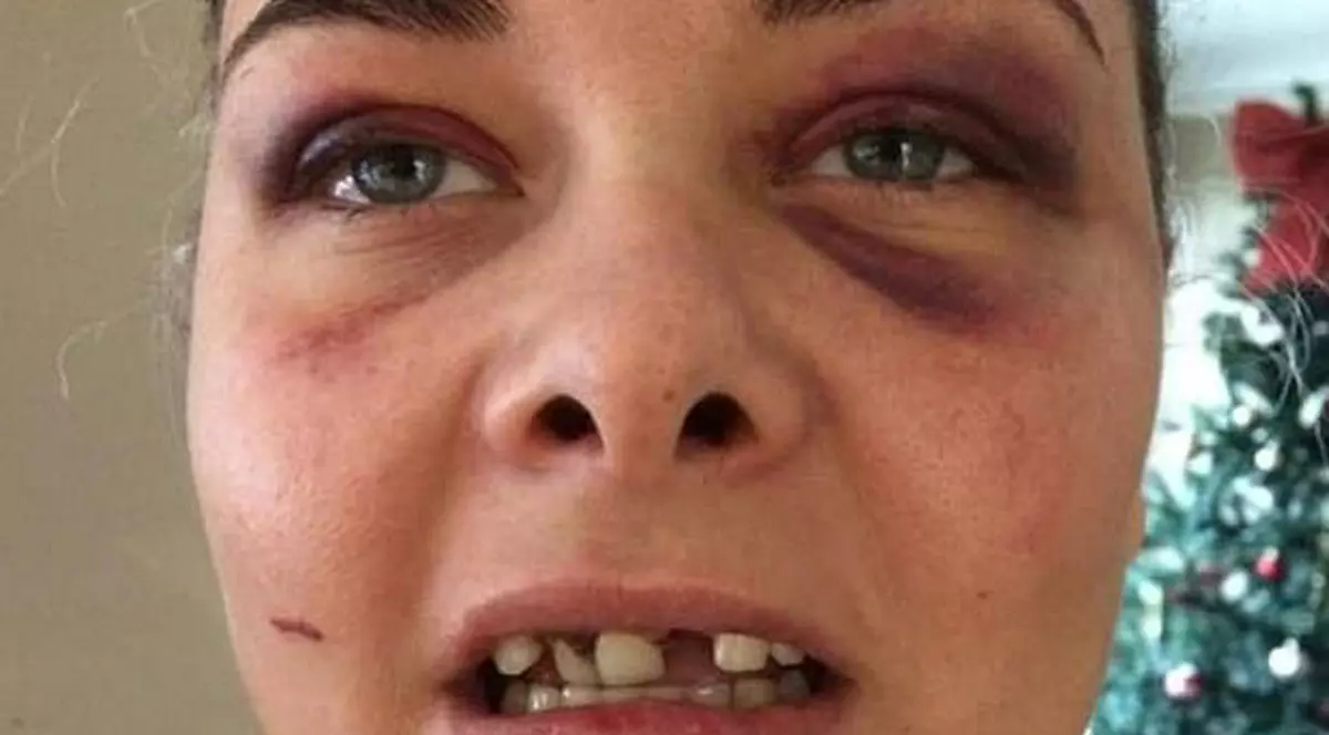 Un bărbat și-a bătut iubita și i-a spart trei dinți din cauză că a schimbat poza de pe Facebook și el nu mai apărea în ea