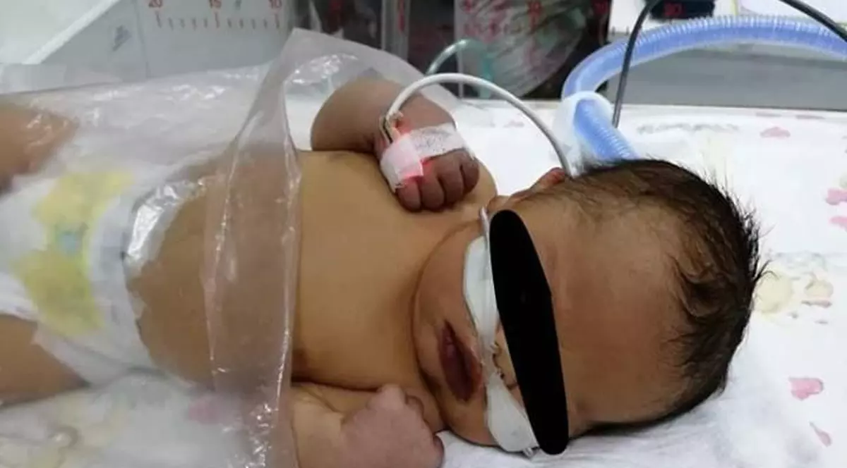 Bebeluș din Cluj cu malformație gravă la inimă, salvat de medicii britanici