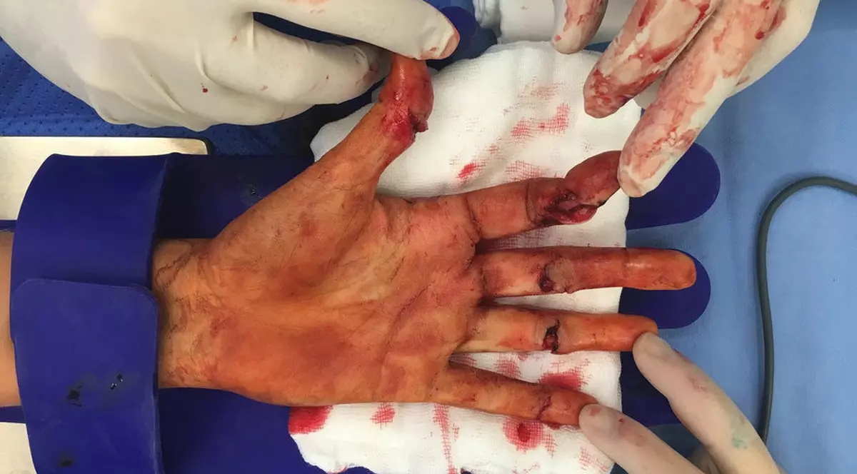 Calvarul trăit de Petra Kvitova în timpul atacului suferit în propria casă: "Mi-a pus cuțitul la gât. M-am tăiat când l-am apucat cu ambele mâini" | GALERIE FOTO