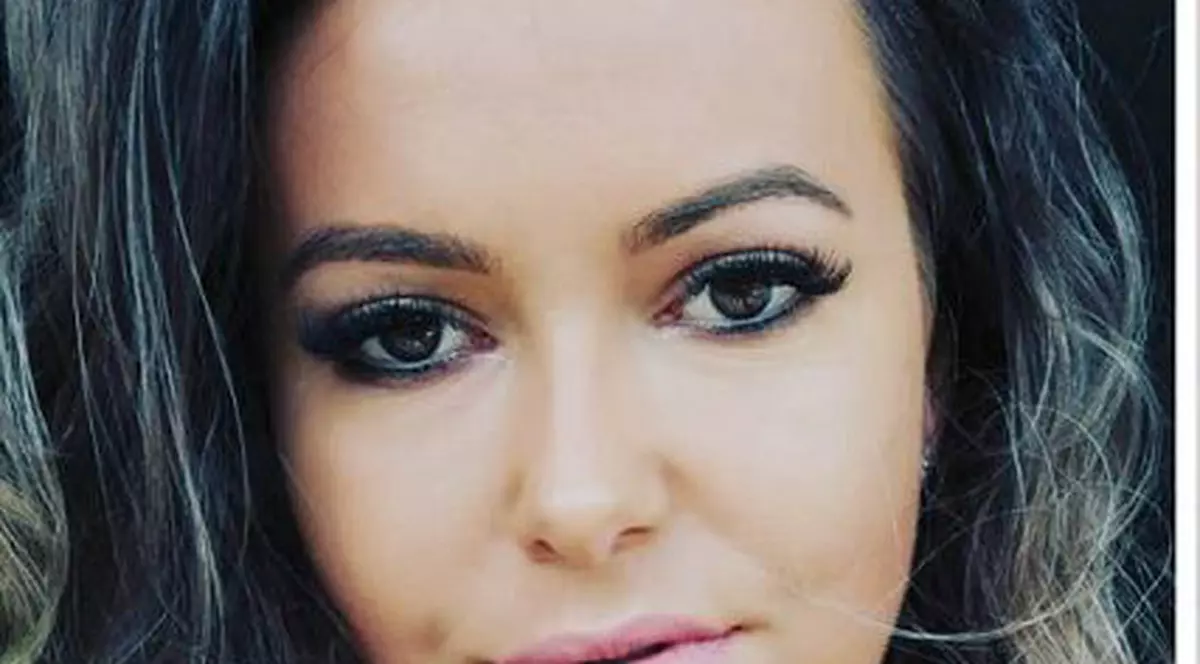 Nico de la „Insula iubirii” și-a mărit buzele. Fosta concurentă a publicat imaginea din timpul intervenției