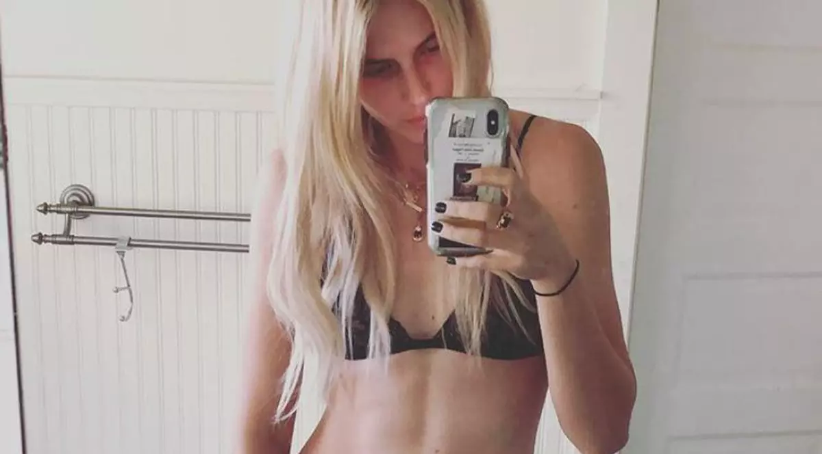 Un model american a rămas fără picioare după ce a folosit un tampon și mai avea doar 1% șanse de supraviețuire. Drama prin care a trecut tânăra