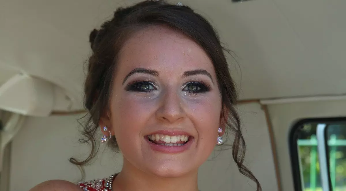 O fată care abia reînvățase să meargă a paralizat din nou