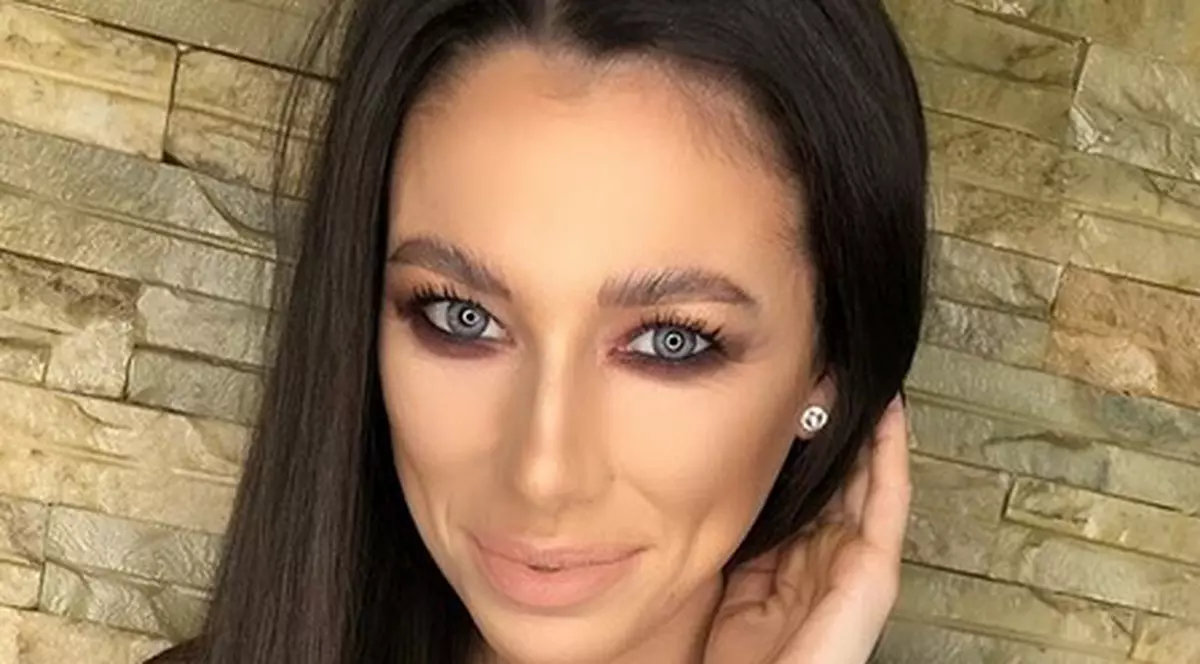 Cum arată Roxana Vancea după operația la nas. Ce transformare. „Misiune îndeplinită”