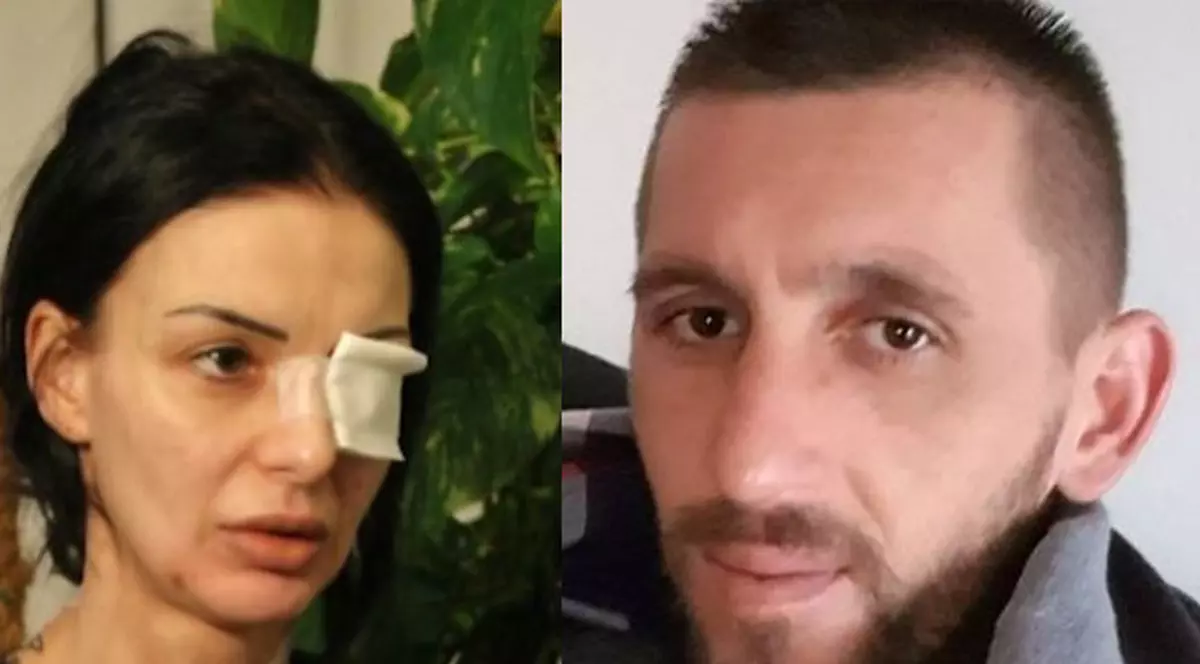 Macedoneanul care a desfigurat cu acid o româncă în Italia