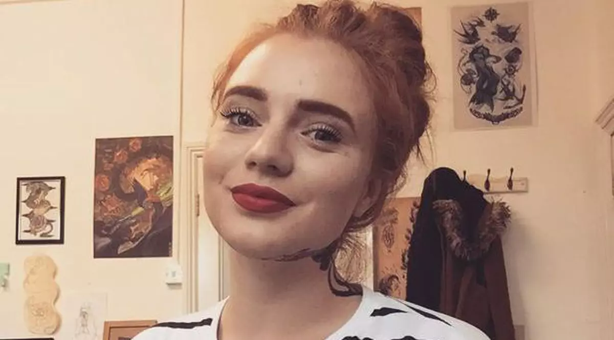 O tânără s-a trezit paralizată la o săptămână după ce medicii i-au pus diagnosticul greșit